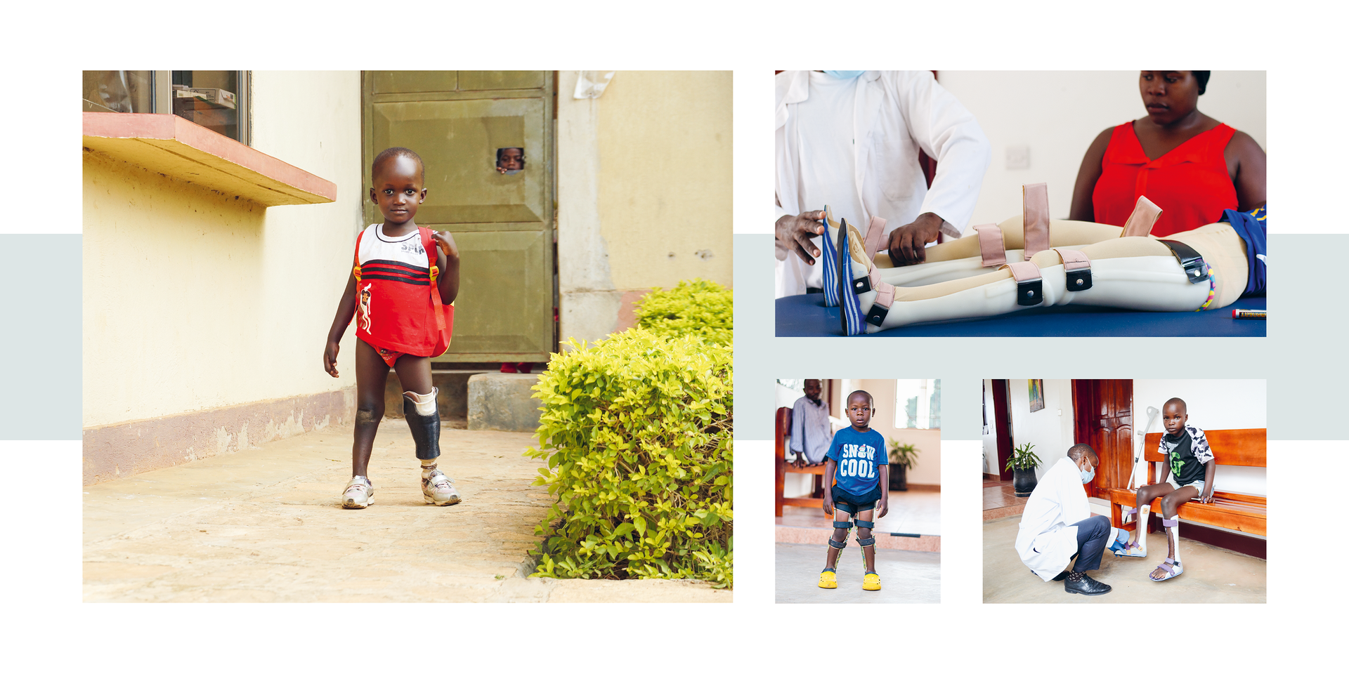 Pro Uganda – Passo dopo passo verso una vita dignitosa Un bambino con una gamba protesica cammina all’esterno di un edificio; immagini più piccole mostrano l’adattamento di una protesi e un bambino con una gamba artificiale assistito da un professionista.